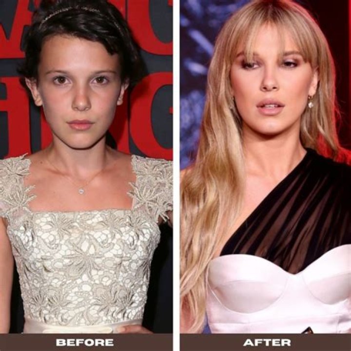 Millie Bobby Brown's Plastic Surgery: Uncovering The Truth